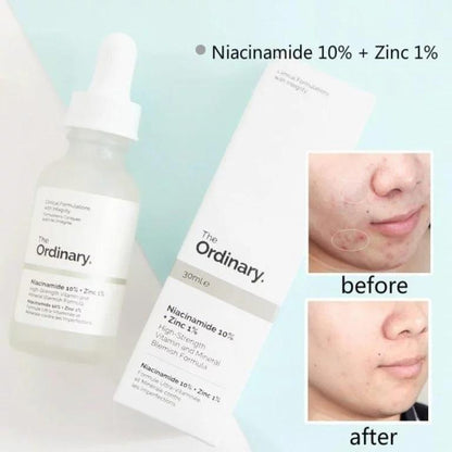 Skin Brightening Niacinamide Serum – 30 ml Trend Nexus
